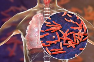 A New Approach to Tuberculosis Treatment Using Nanocarriers 1