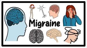 Prevention of Migraine: Сheap medicines turned out to be no less effective than expensive ones 1