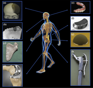 Revolutionizing Medical Technology: The Path to Permanent Implantable Devices 1